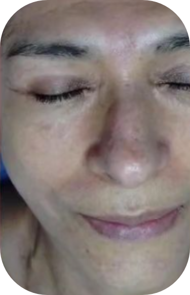 Limpieza facial profunda