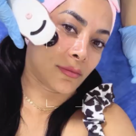 Limpieza facial profunda