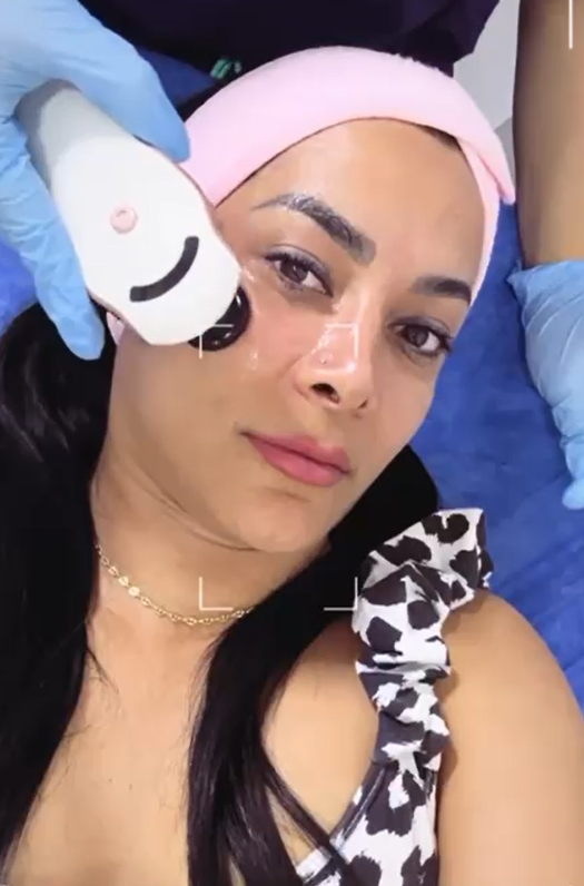 Limpieza facial profunda