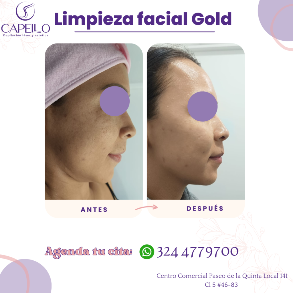 Limpieza facial gold