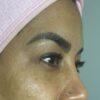 Limpieza facial premium Cali