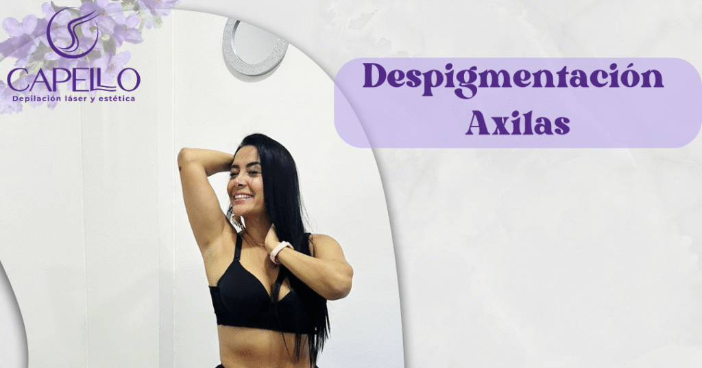 Despigmentación Corporal