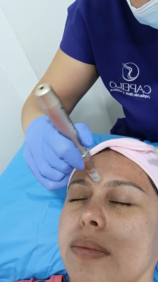 Despigmentación facial